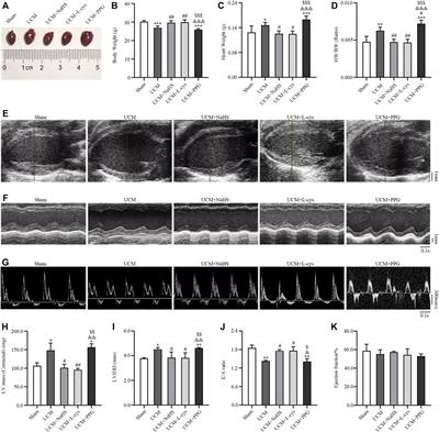 Hydrogen sulfide alleviates uremic cardiomyopathy by regulating PI3K/PKB/mTOR-mediated overactive autophagy in <mark class="highlighted">5/6 nephrectomy</mark> mice